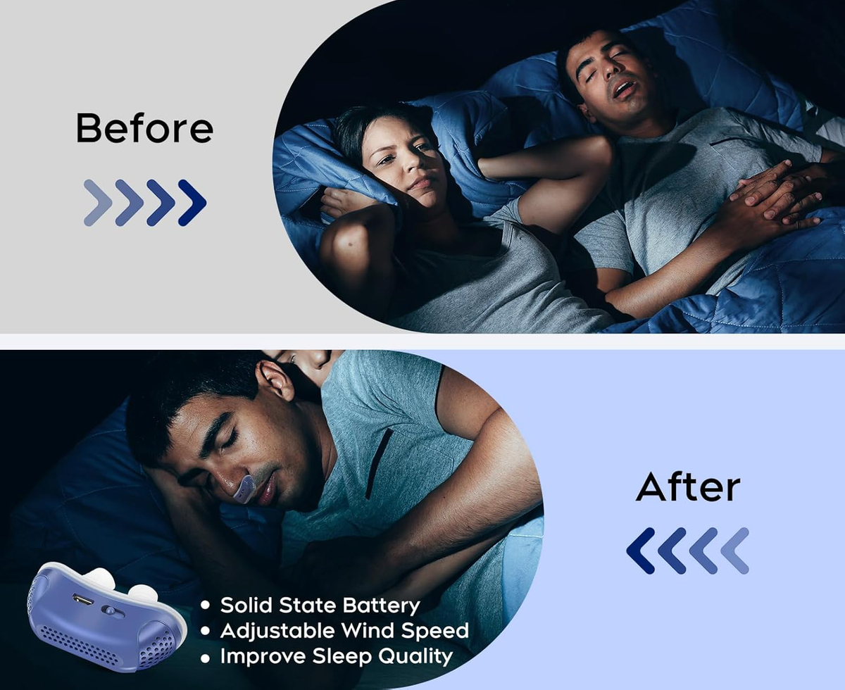 Nasal Breathing Device with Silicone Buds and Electric Pump for Sleep Apnea