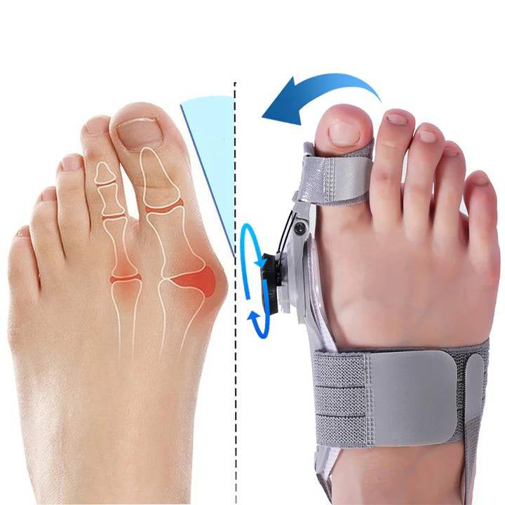 Natural Bunions Corrector Toe Spacer