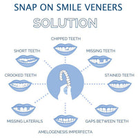 Smile Veneer (Upper & Lower Included)